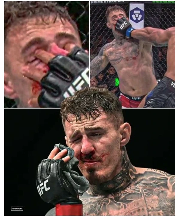 눈 찔린 헤비급 챔피언, 엄살이었나? UFC 대표, "시력 아무 문제 없다, 리매치 한다"