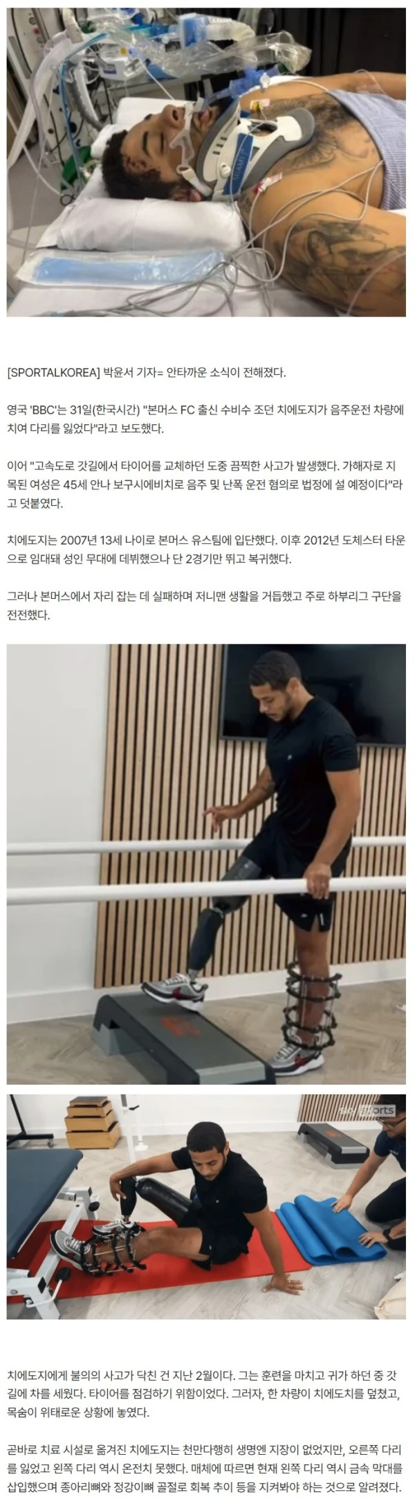 '꽃다운 31세인데' 참극! 안타까운 비보...음주운전 차량에 치여 다리 절단